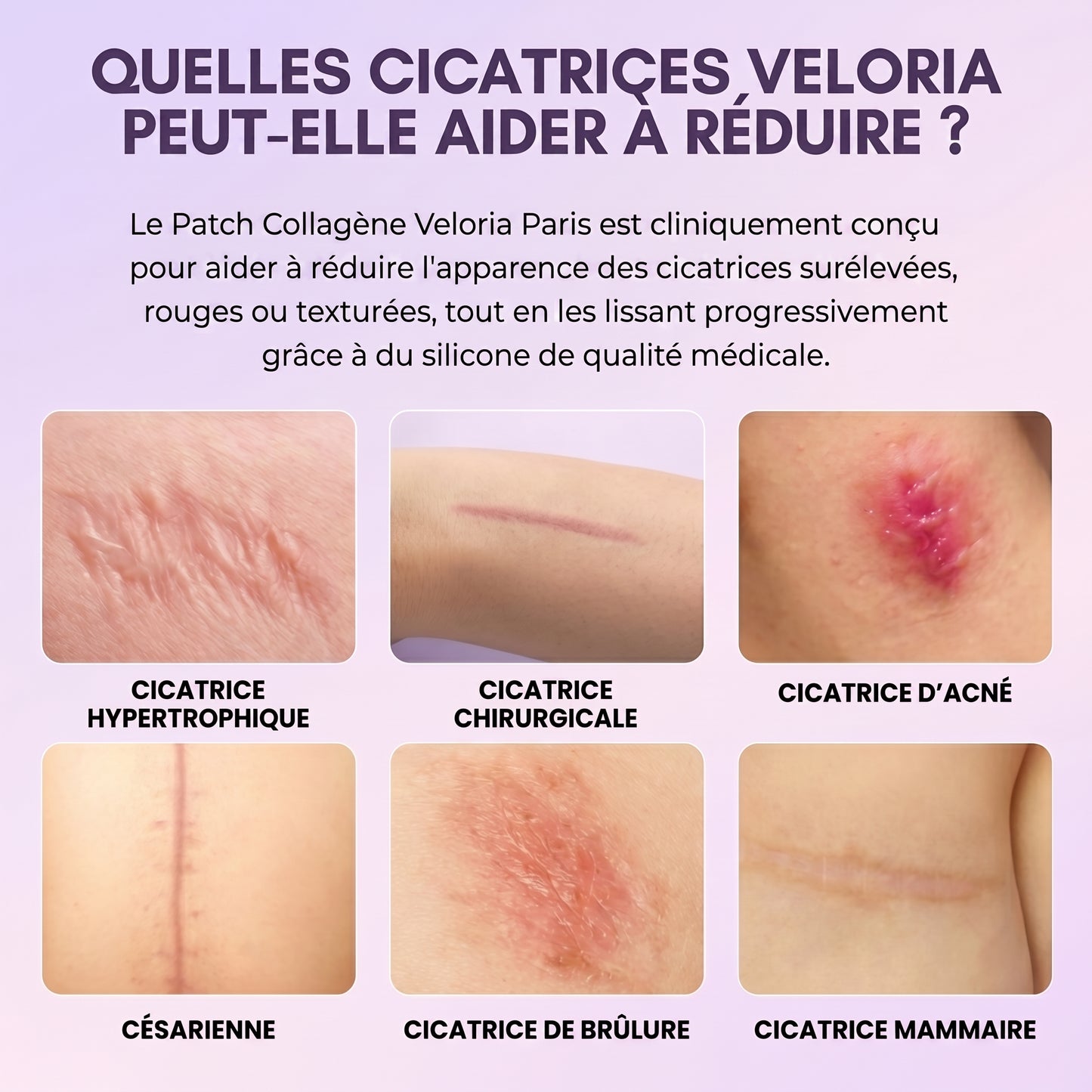 Veloria Paris Patchs Collagène